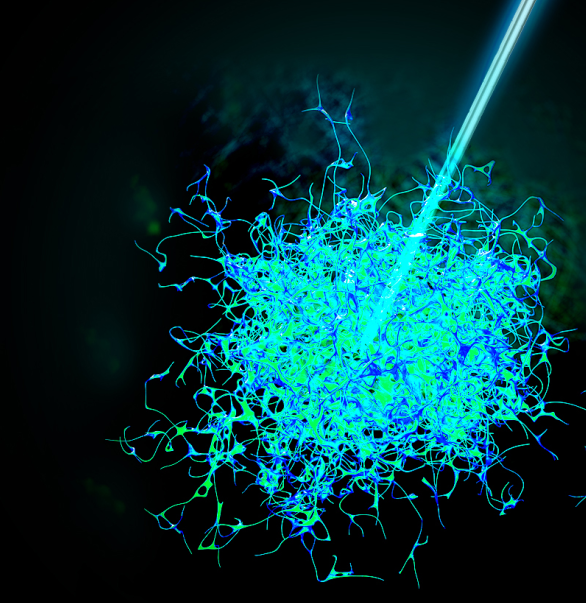 今天，我們把腫瘤的內(nèi)部「融穿」了