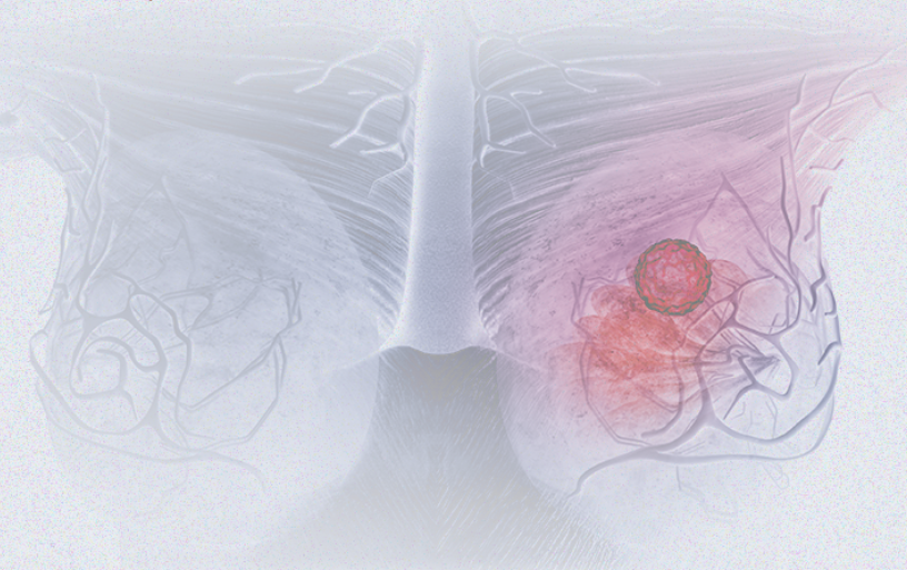 國(guó)際婦女節(jié) | 關(guān)注乳腺癌 微創(chuàng)介入讓美麗繼續(xù)，「乳」愿以償正成為現(xiàn)實(shí)