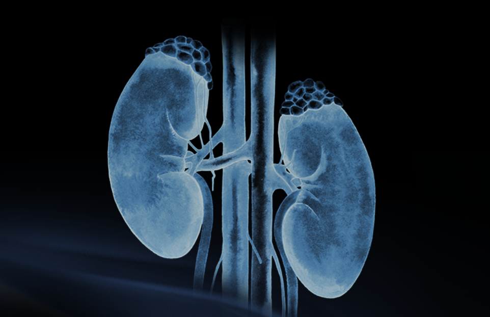 世界腎臟日 | 相得「腎」歡，融有術(shù)、精準(zhǔn)適形